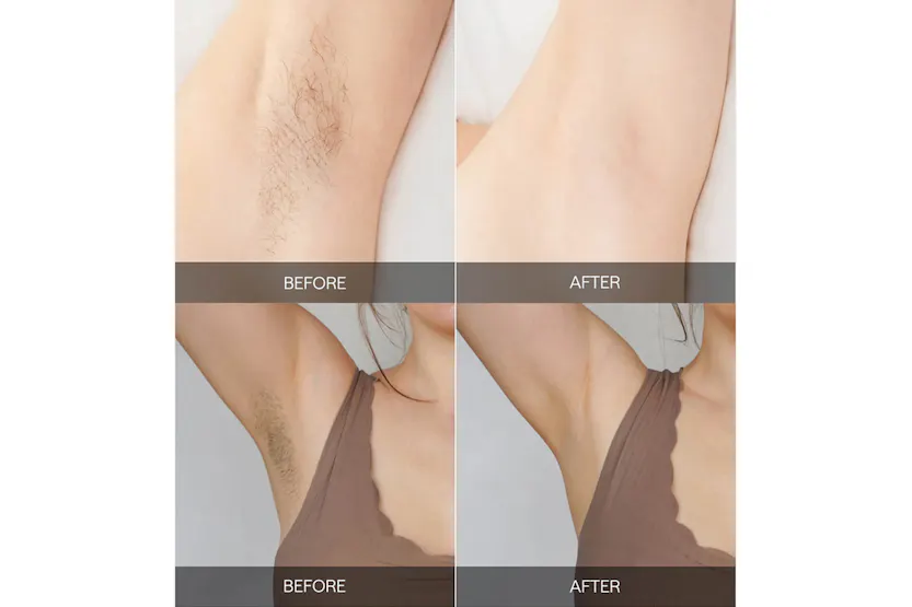 Ulike Air 2 IPL Hair Removal Device | UI04-GR-UK Ulike Air 2 IPL Hair Removal Device | UI04-GR-UK