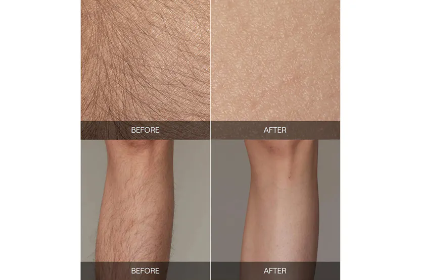 Ulike Air 2 IPL Hair Removal Device | UI04-GR-UK Ulike Air 2 IPL Hair Removal Device | UI04-GR-UK